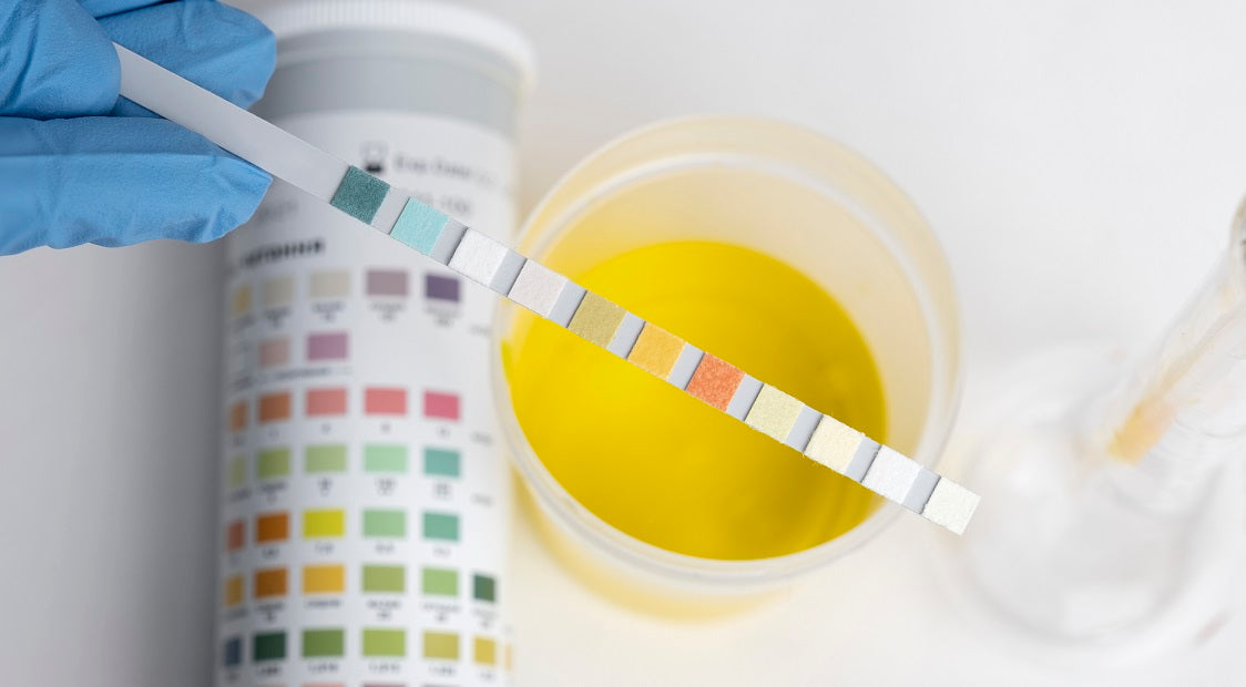 Glycosuria-test