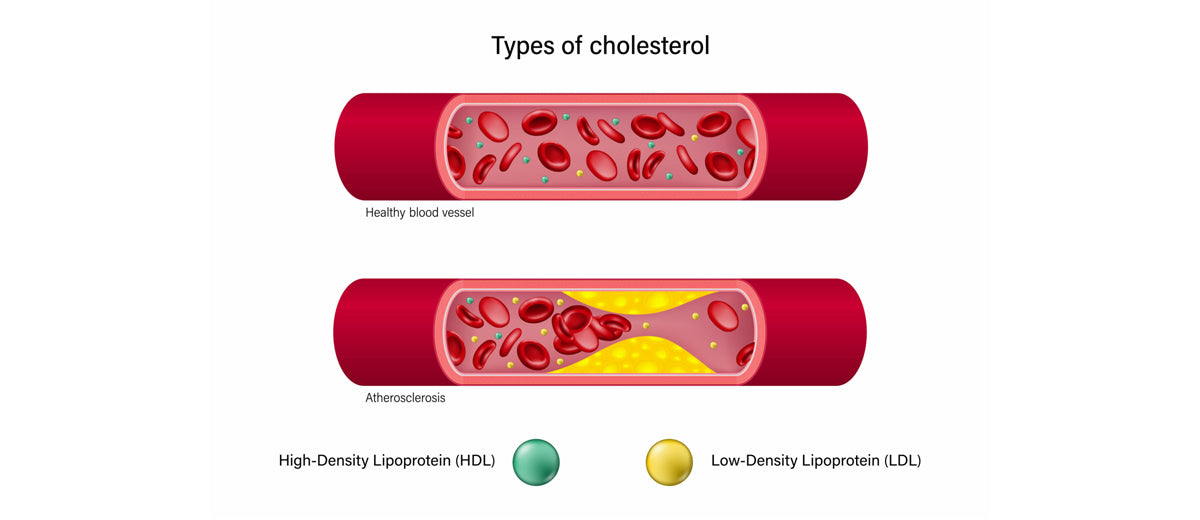 HDL and LDL
