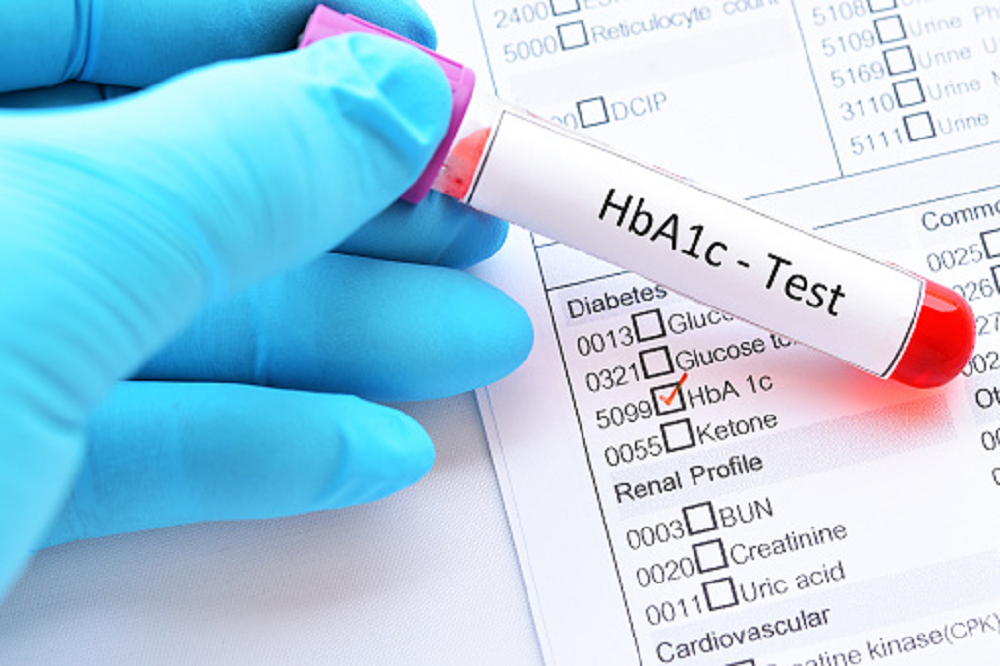 HbA1c