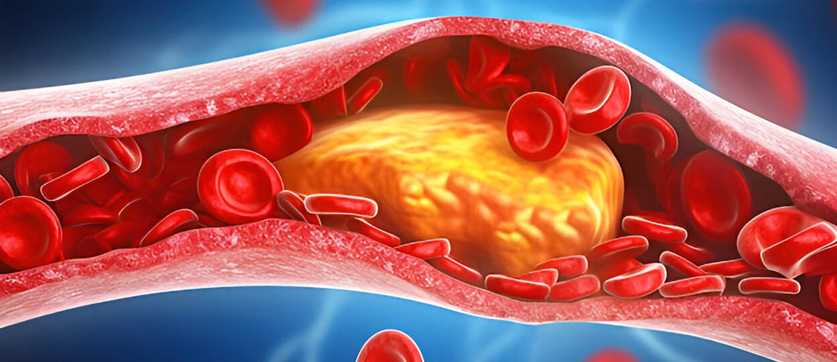 LDL-cholesterol-bad-cholesterol